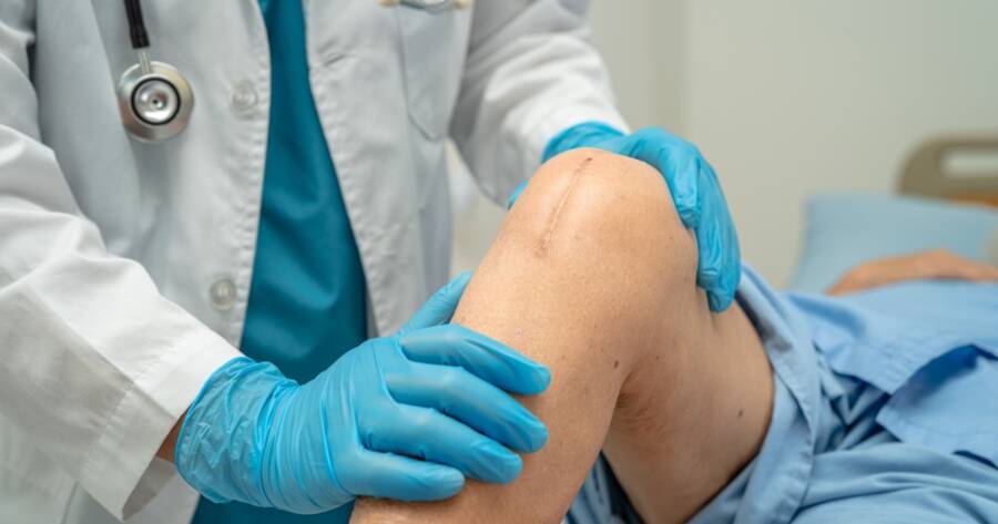 Patients Weigh Knee Replacement Claims After Reports of Implant Problems