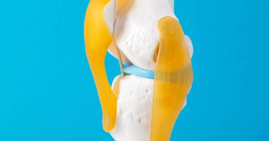 Knee Replacement Recall Claims Raise New Questions for Implant Patients