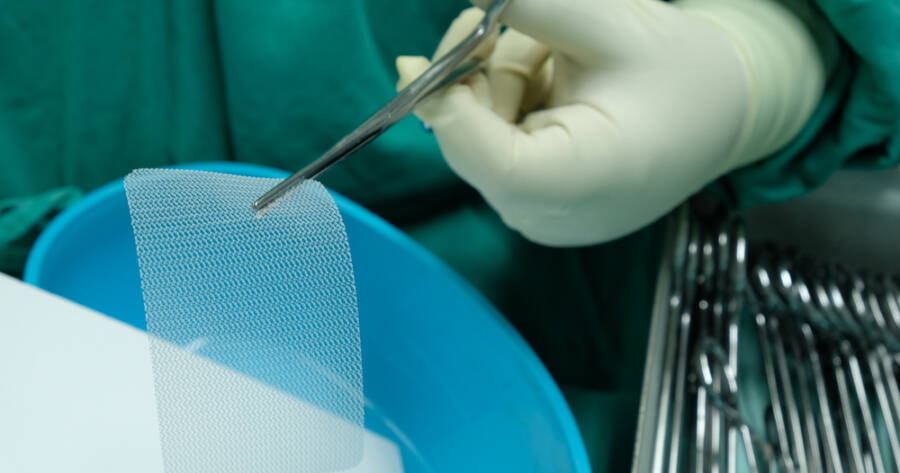 Hernia Mesh Damage Claims: Key Questions to Address